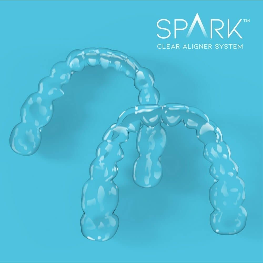 Spark Aligners vs. Invisalign: An Honest Comparison (From a Milwaukee Orthodontist)