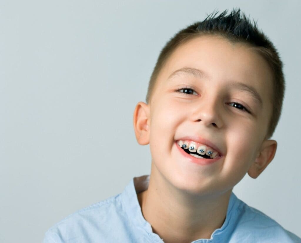 Braces for Kids & Teens